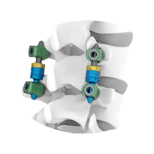 Sistema-de-Fijacion-Lumbar